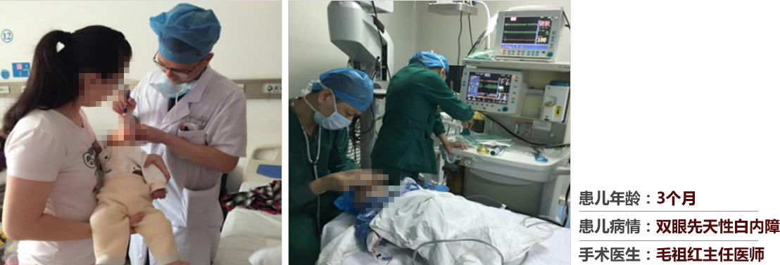 患兒年齡：3個月，患兒病情：雙眼先天性白內障，手術醫(yī)生：毛祖紅主任醫(yī)師
