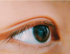 倒睫是由什么原因引起的？