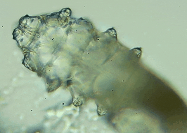 睫毛上驚現(xiàn)80只螨蟲！別揉了，快自查下你的眼睛有沒有......