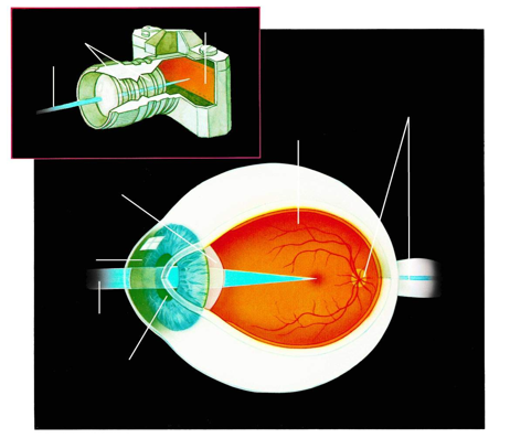 白內(nèi)障原因