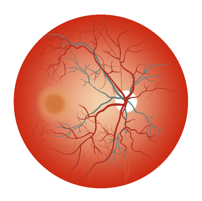預(yù)防黃斑變性